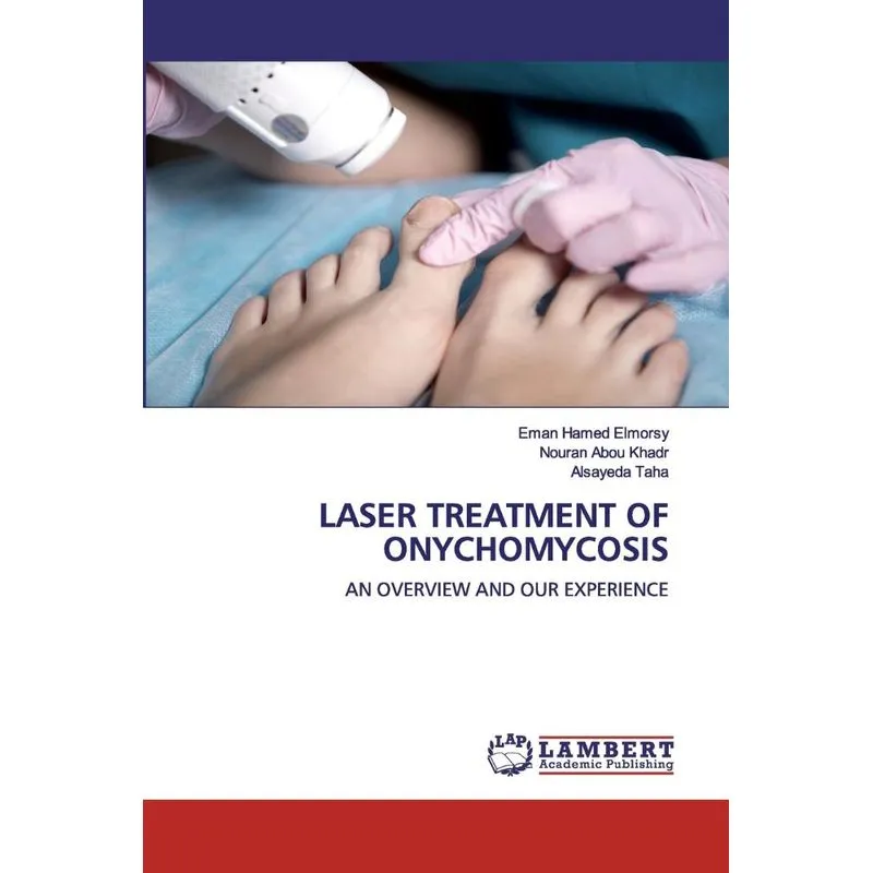 LASER TREATMENT OF ONYCHOMYCOSIS