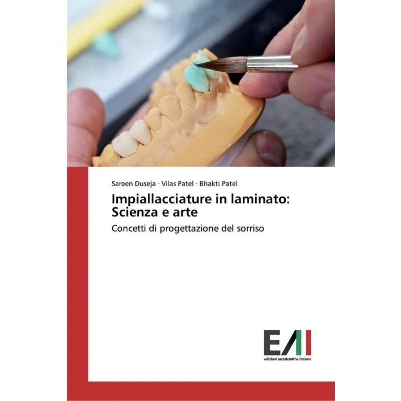 Impiallacciature in laminato