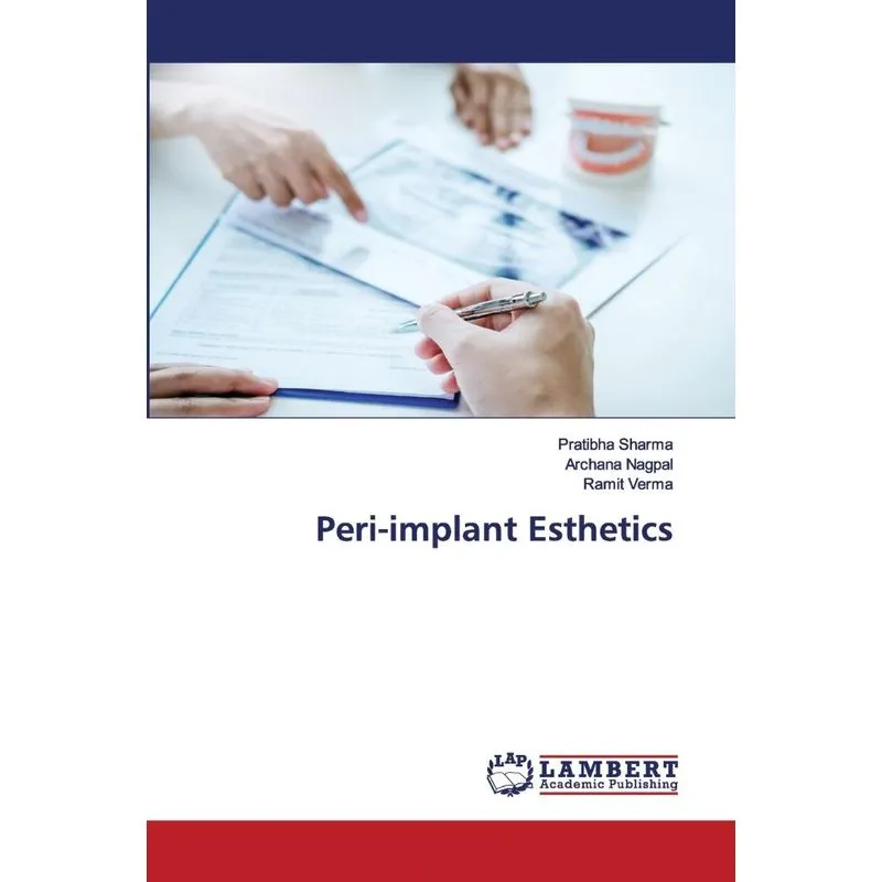 Peri-implant Esthetics