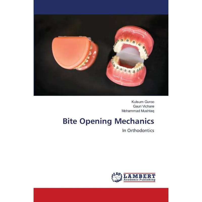 Bite Opening Mechanics