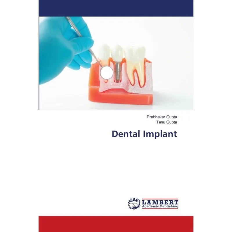 Dental Implant