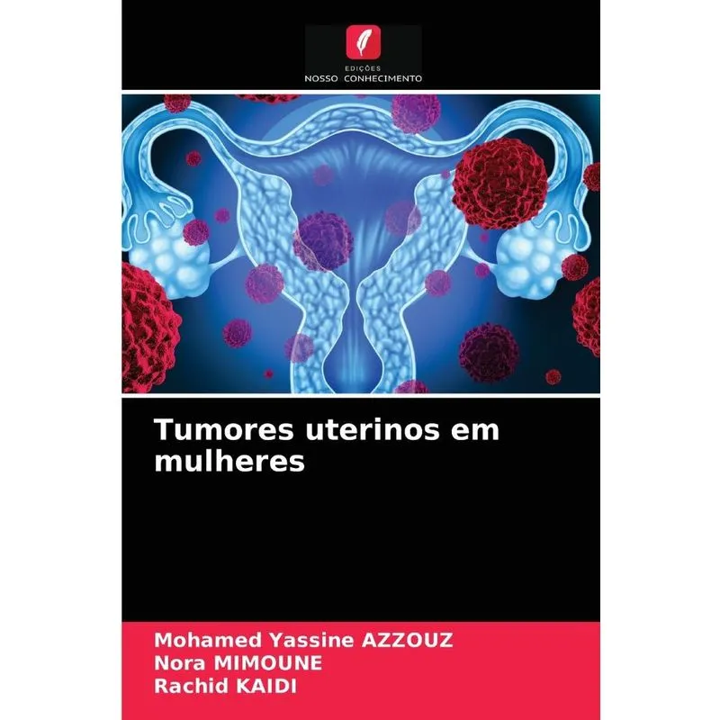 Tumores uterinos em mulheres
