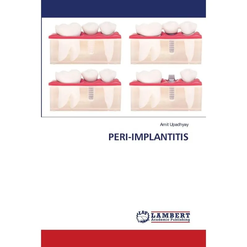 PERI-IMPLANTITIS