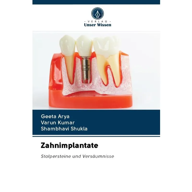 Zahnimplantate