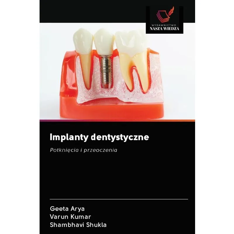 Implanty dentystyczne