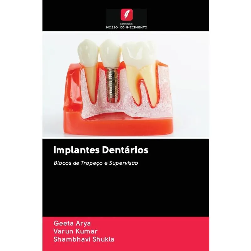 Implantes Dentários