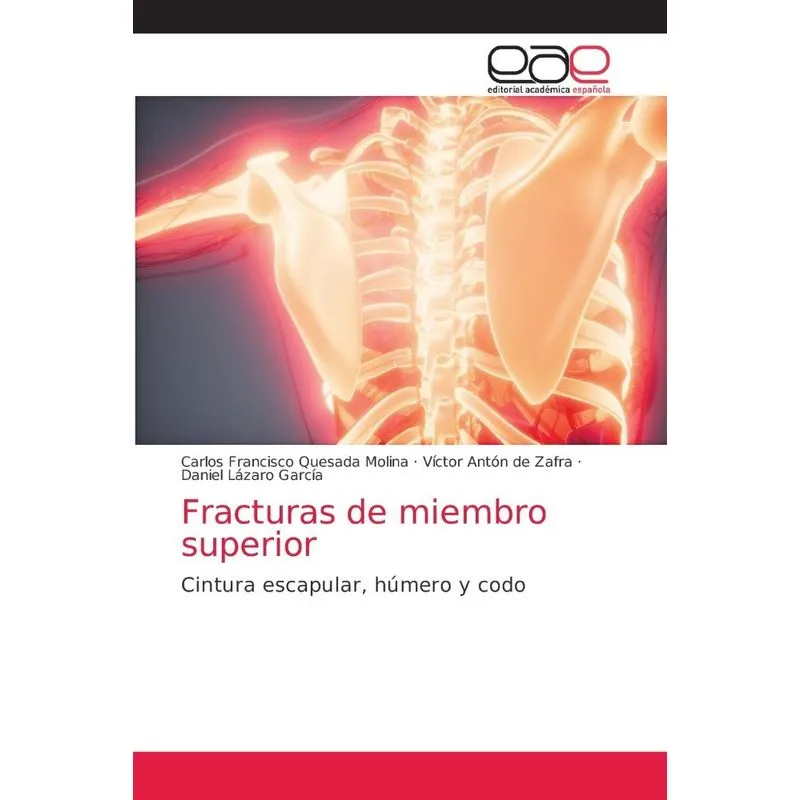Fracturas de miembro superior