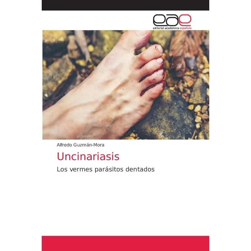 Uncinariasis