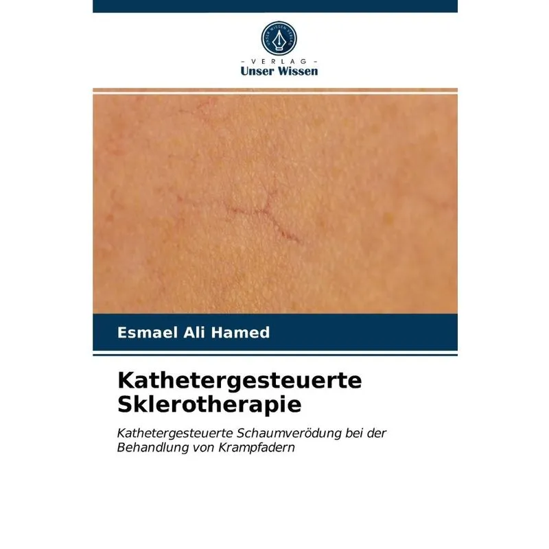 Kathetergesteuerte Sklerotherapie