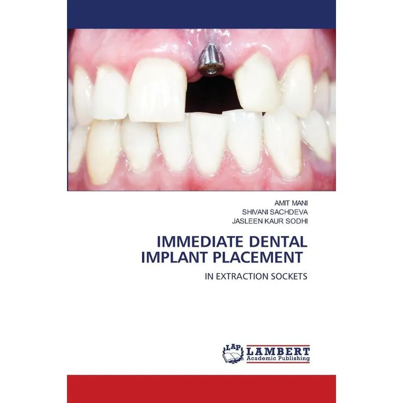 IMMEDIATE DENTAL IMPLANT PLACEMENT