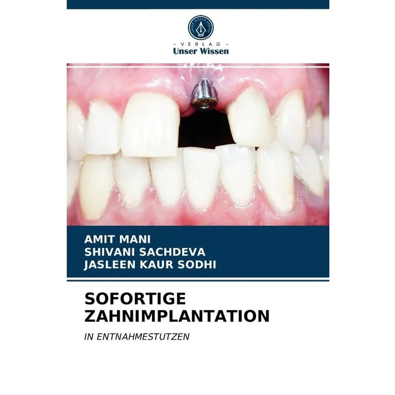 SOFORTIGE ZAHNIMPLANTATION