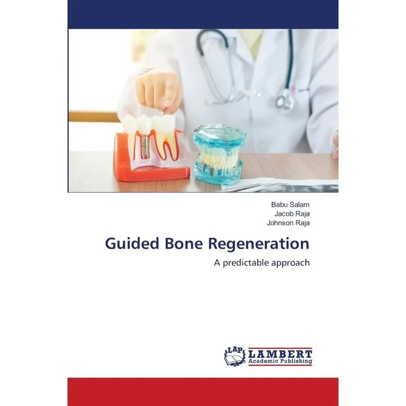 Guided Bone Regeneration
