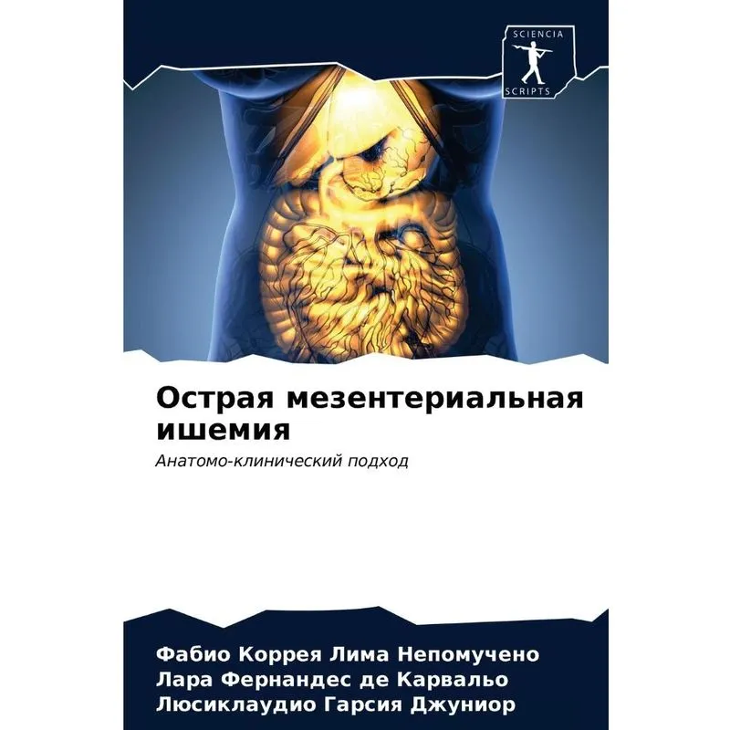 Острая Мезентериальная Ишемия
