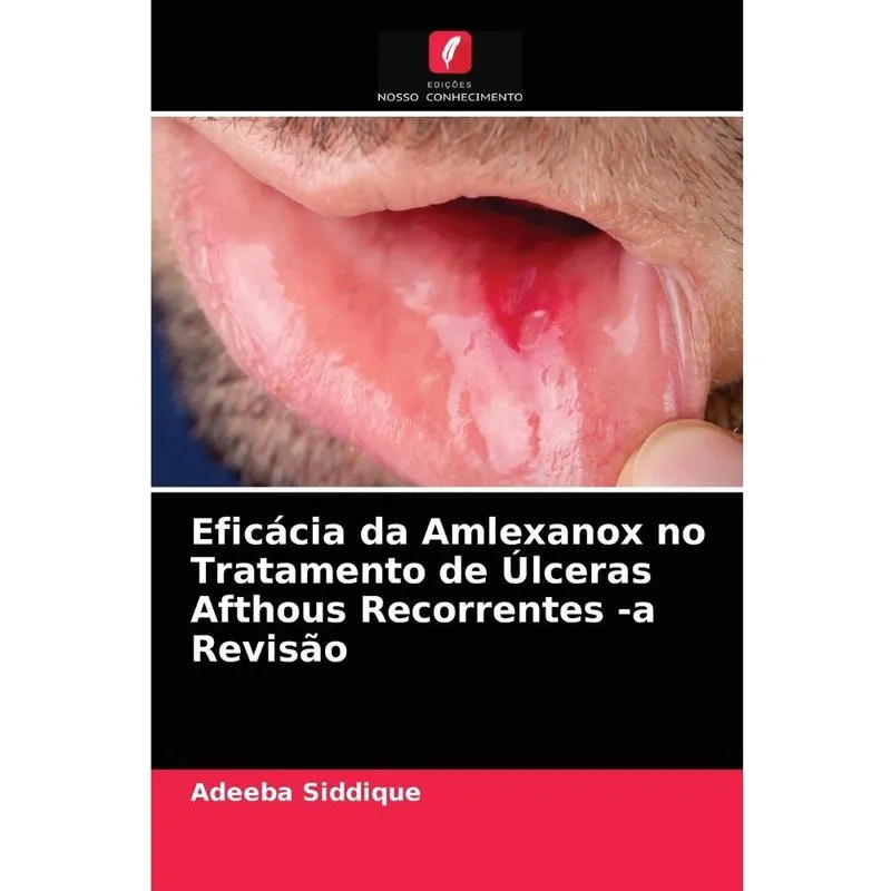 Eficácia da Amlexanox no Tratamento de Úlceras Afthous Reco