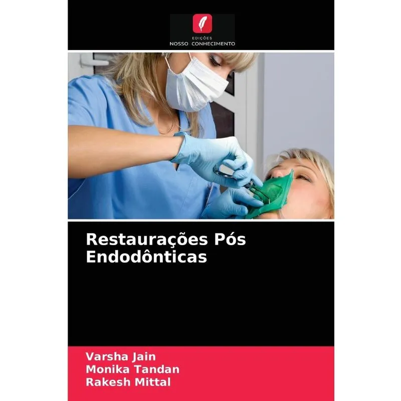 Restaurações Pós Endodônticas