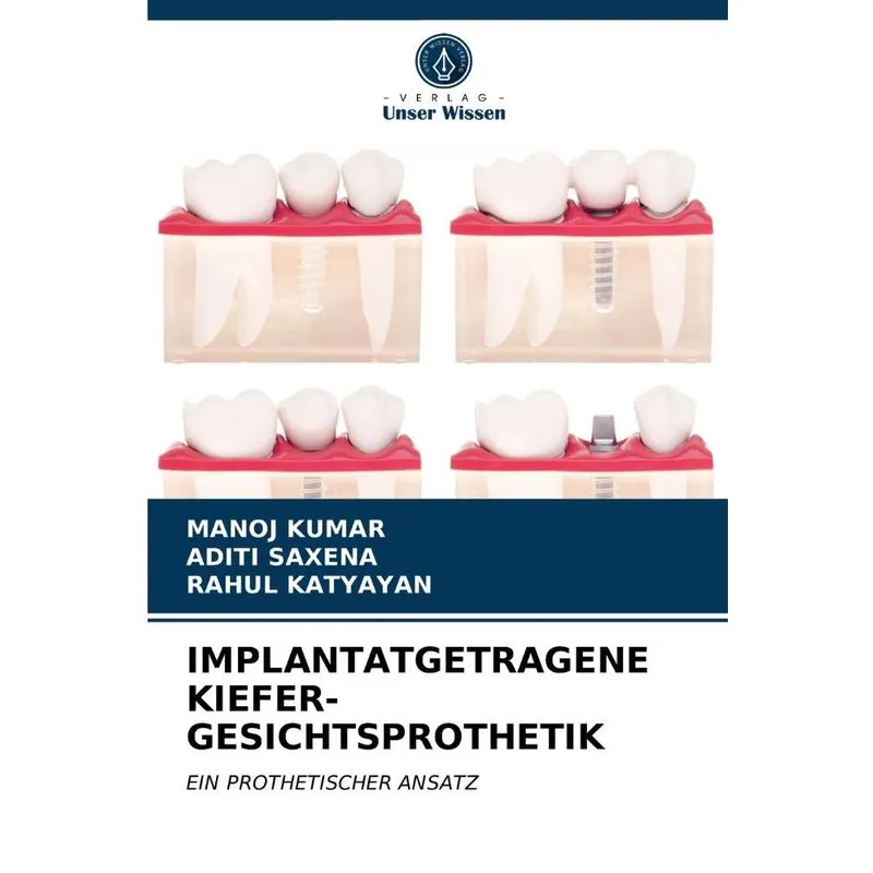 IMPLANTATGETRAGENE KIEFER-GESICHTSPROTHETIK