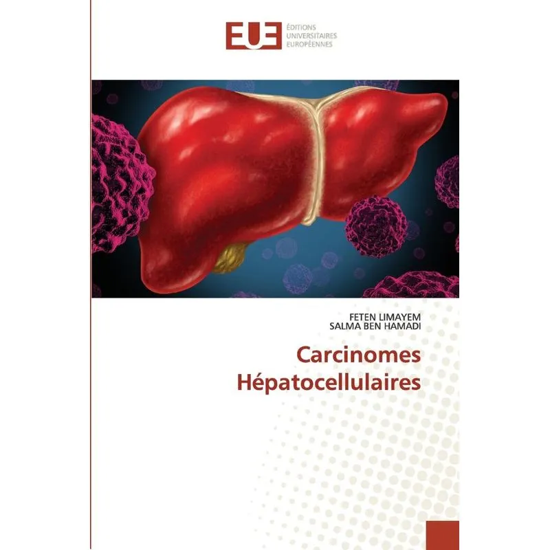 Carcinomes Hépatocellulaires