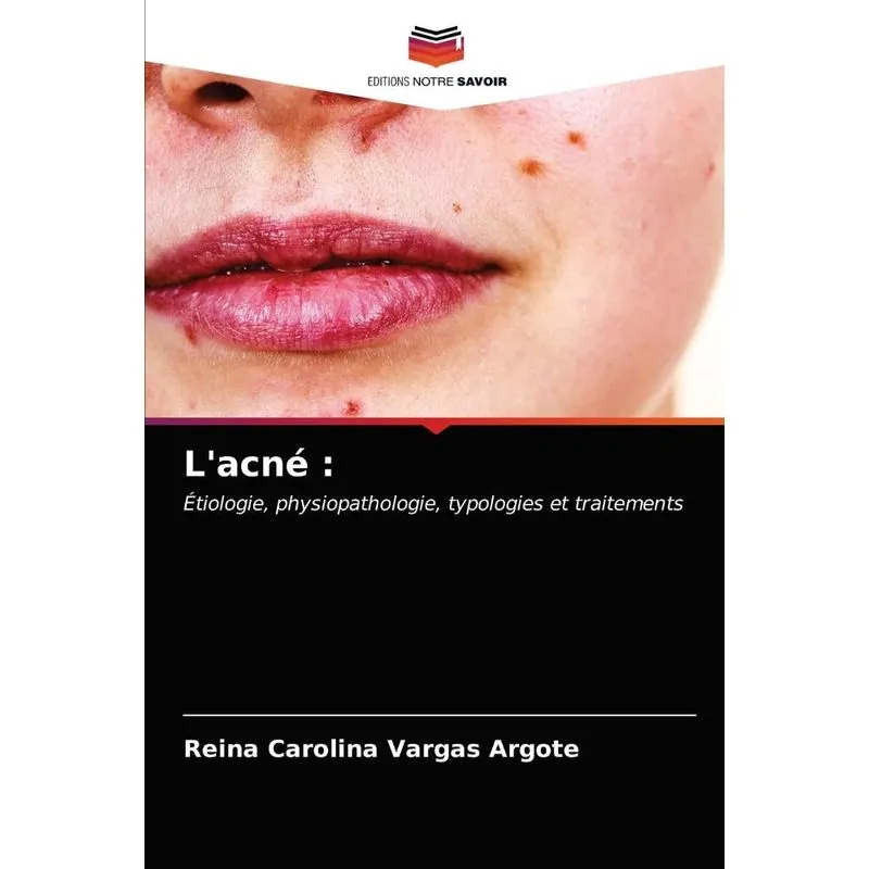 Lacné
