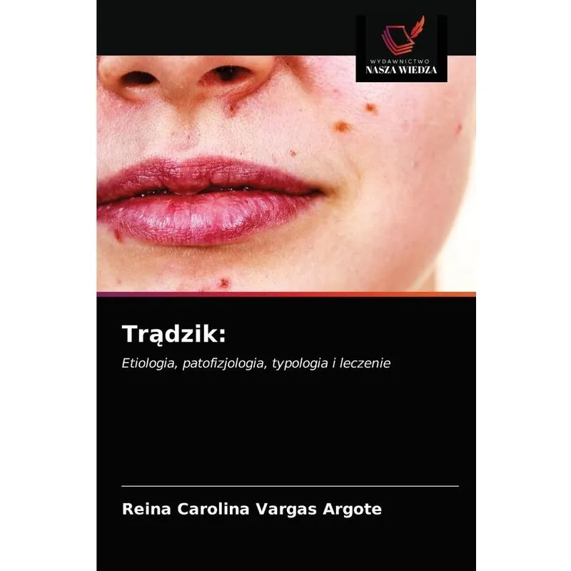 Tradzik