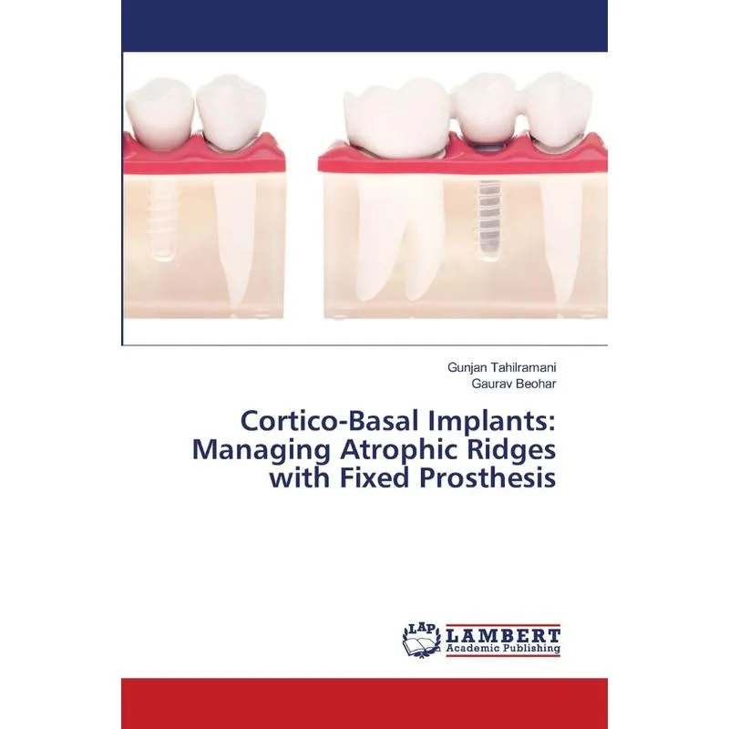 Cortico-Basal Implants
