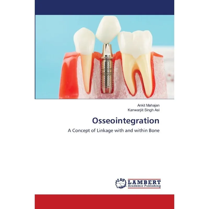 Osseointegration