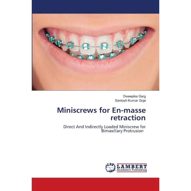 Miniscrews for En-masse retraction