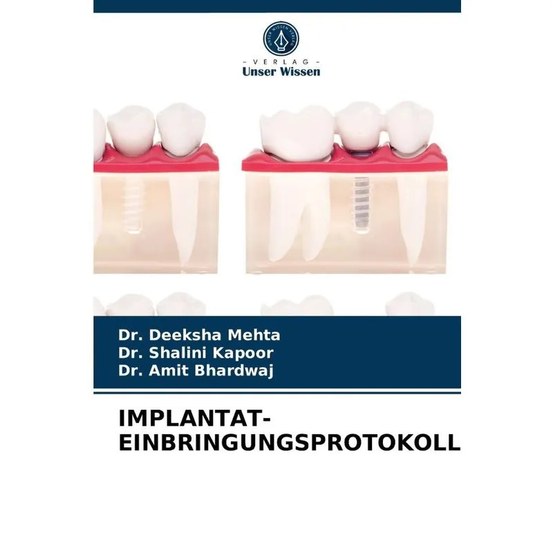 IMPLANTAT-EINBRINGUNGSPROTOKOLL