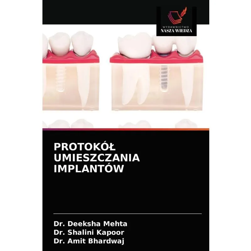 PROTOKÓL UMIESZCZANIA IMPLANTÓW