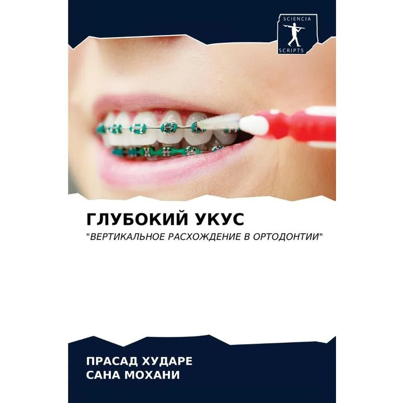 Глубокий Укус