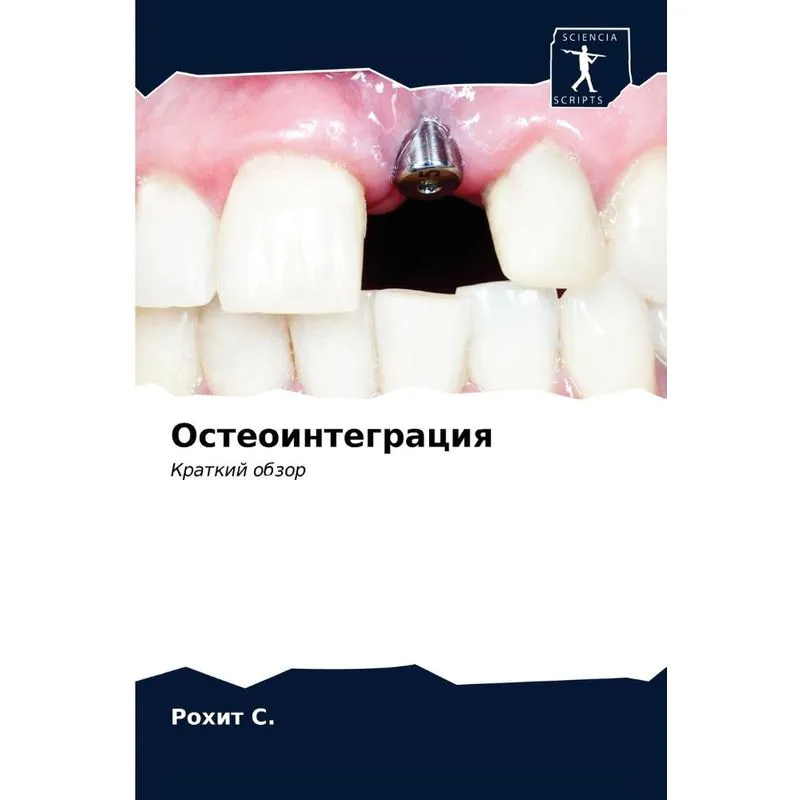 Остеоинтеграция
