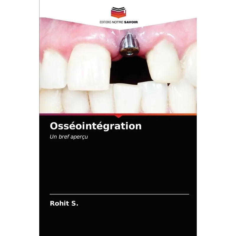 Osséointégration