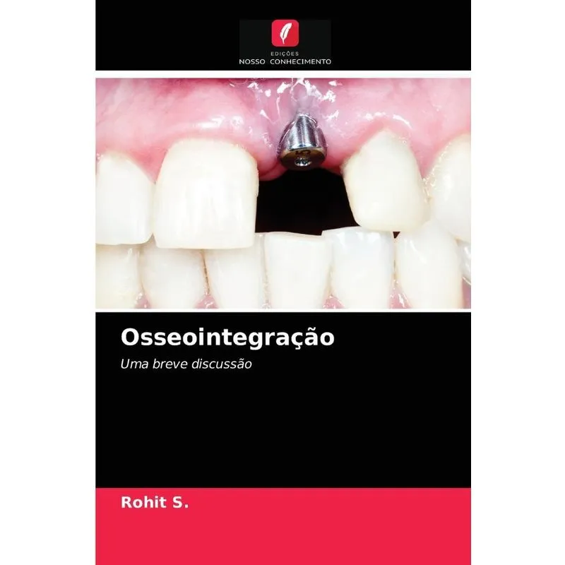 Osseointegração