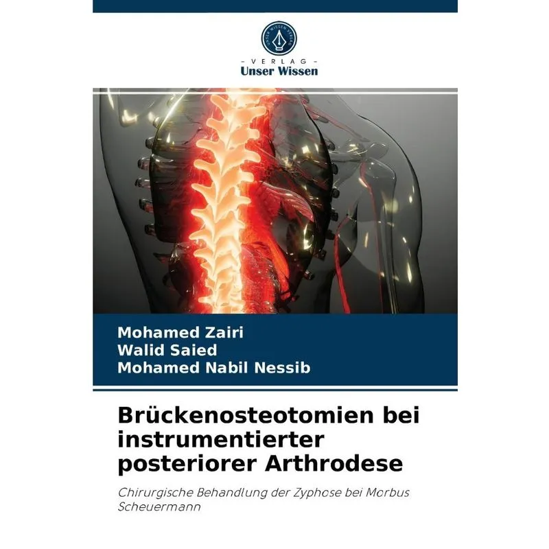 Brückenosteotomien bei instrumentierter posteriorer Arthrod
