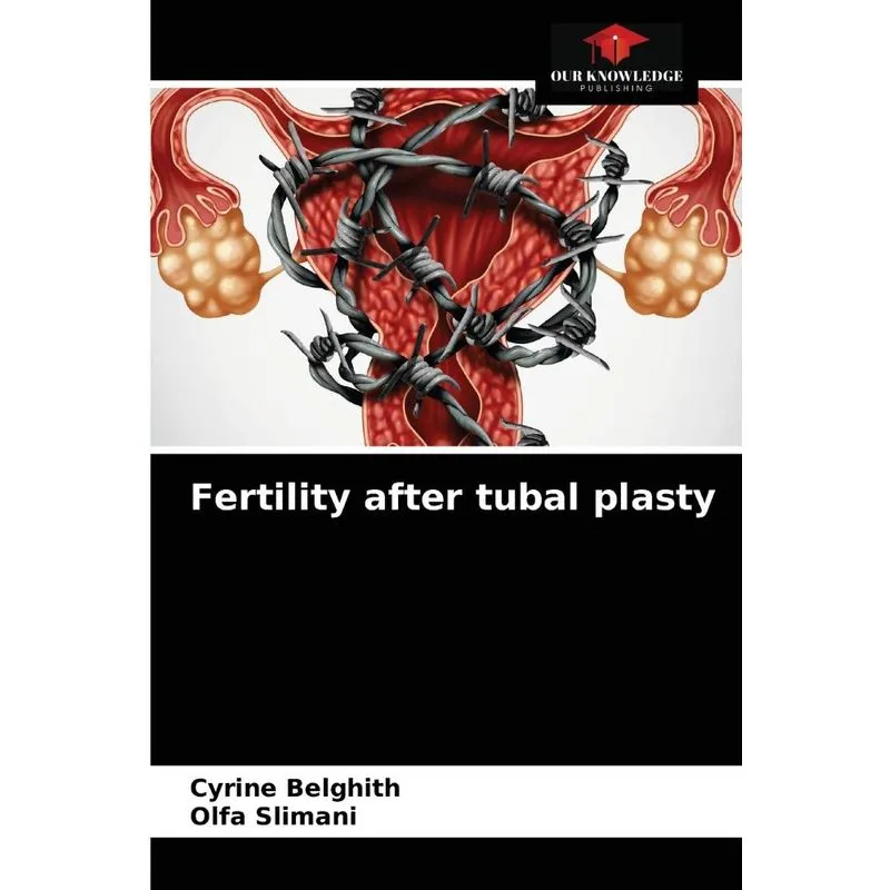 Fertility After Tubal Plasty