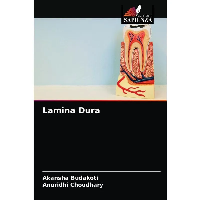 Lamina Dura