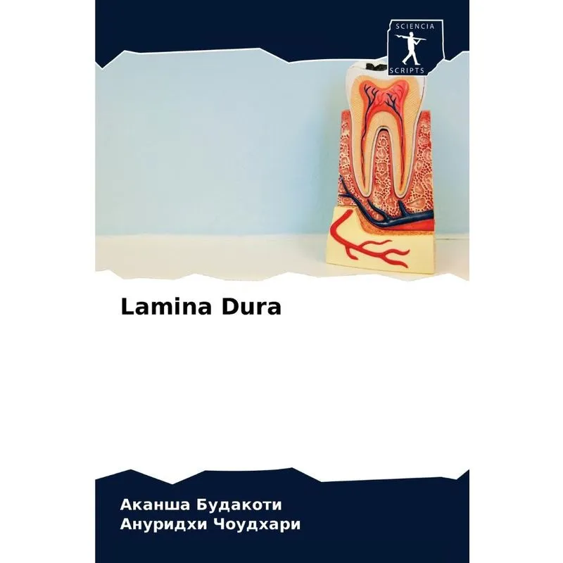 Lamina Dura