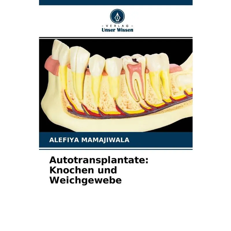 Autotransplantate