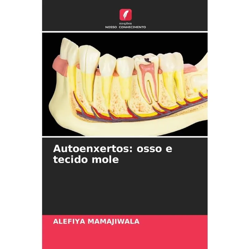 Autoenxertos