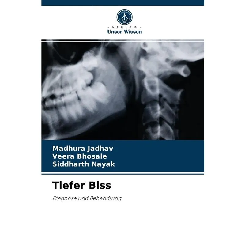 Tiefer Biss