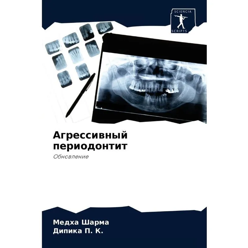 Агрессивный Периодонтит