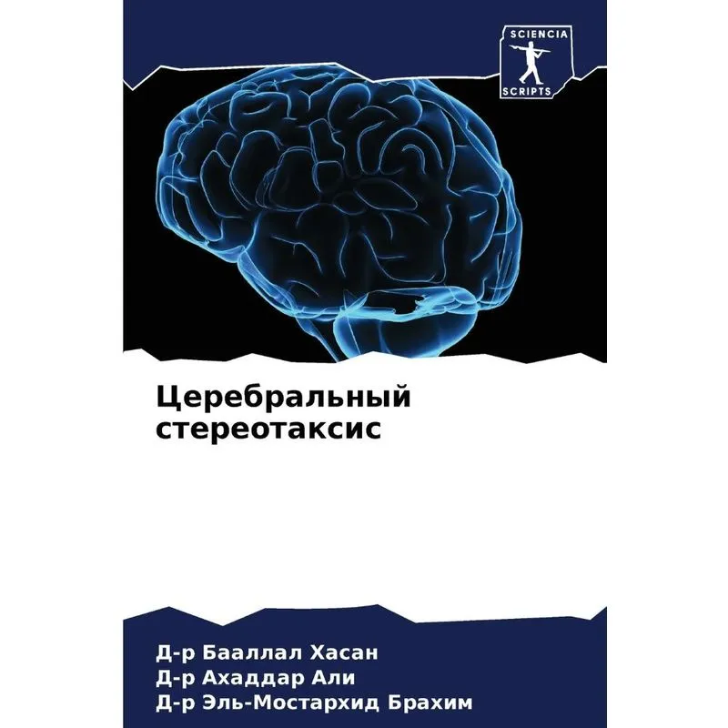 Церебральный Стереотаксис