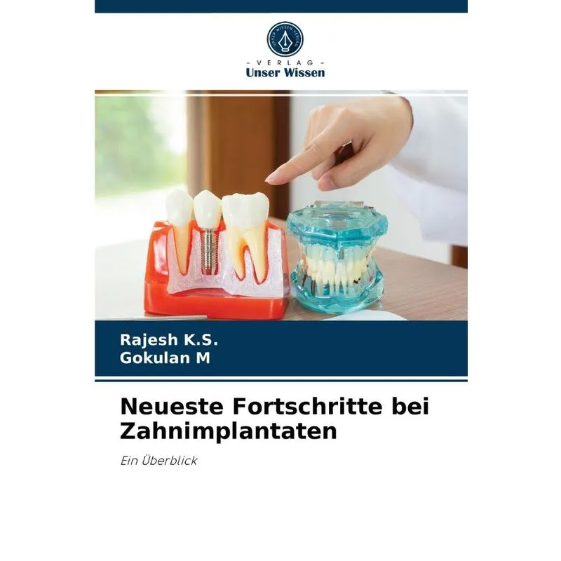 Neueste Fortschritte Bei Zahnimplantaten