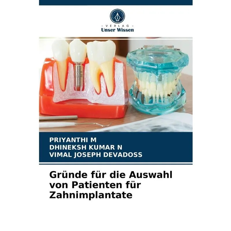 Gründe Für Die Auswahl Von Patienten Für Zahnimplantate