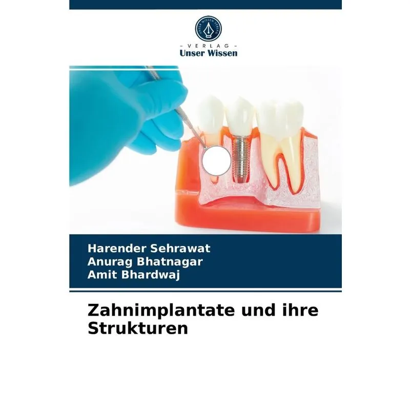Zahnimplantate Und Ihre Strukturen