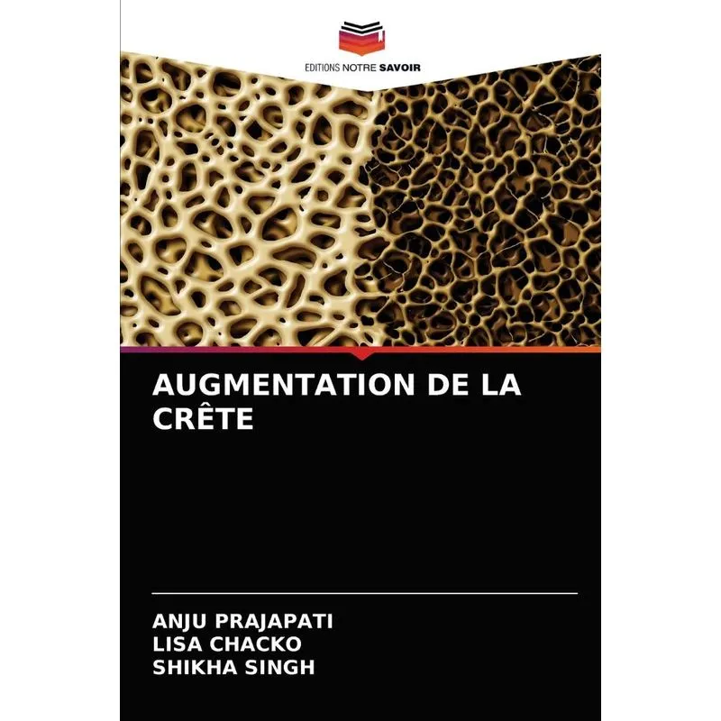 AUGMENTATION DE LA CRÊTE