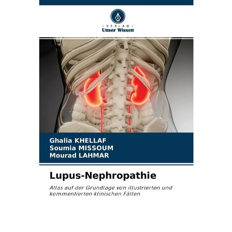 Lupus-nephropathie