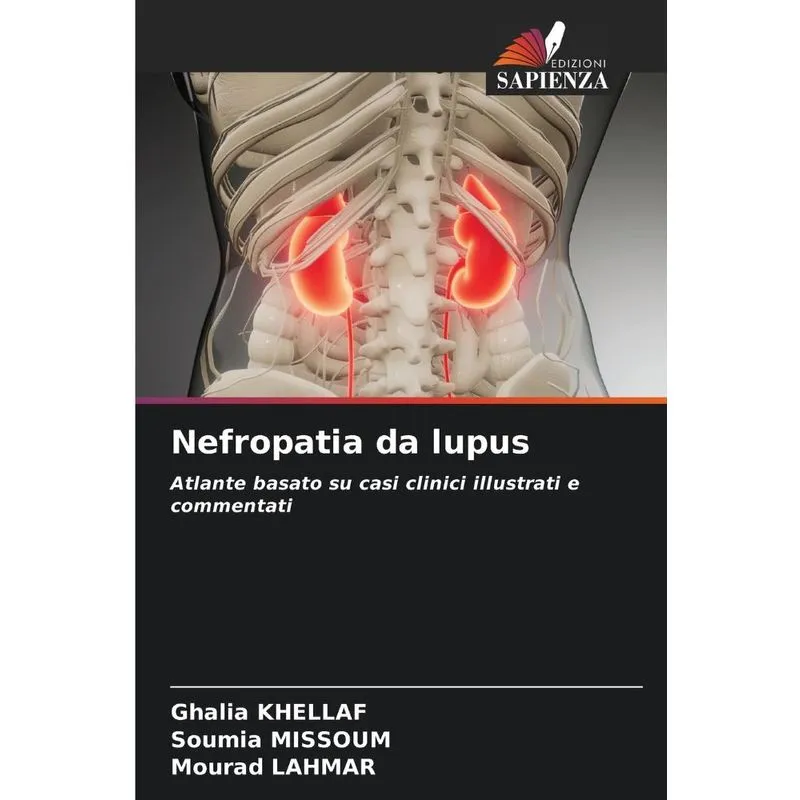 Nefropatia Da Lupus
