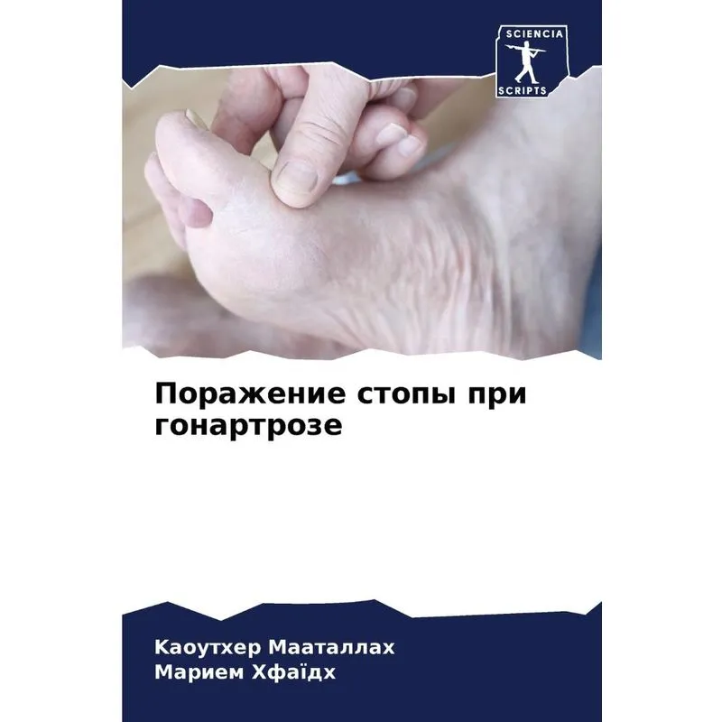 Поражение Стопы При Гонартрозе
