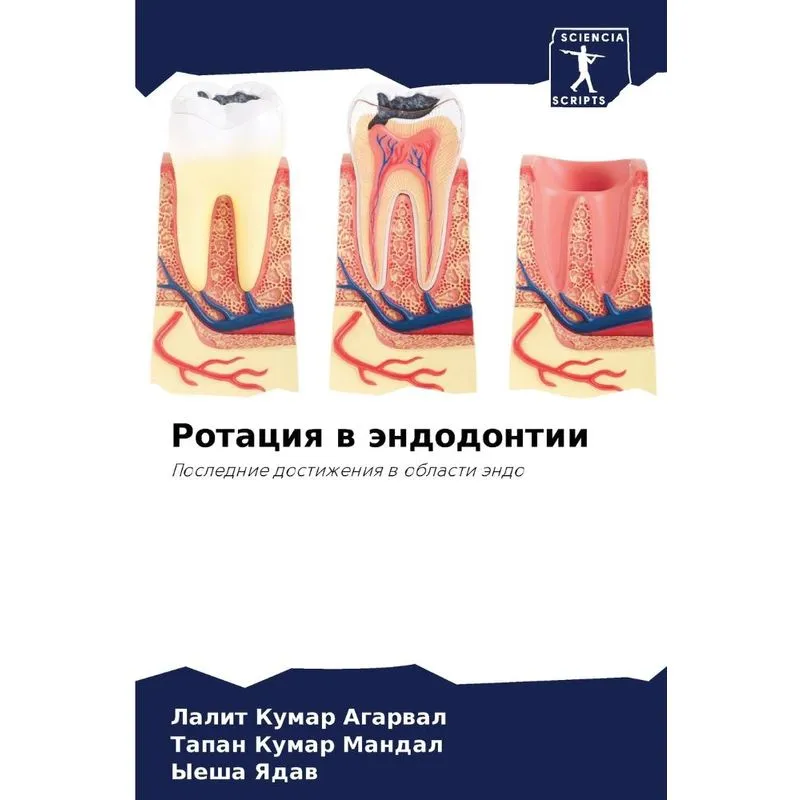 Ротация В Эндодонтии