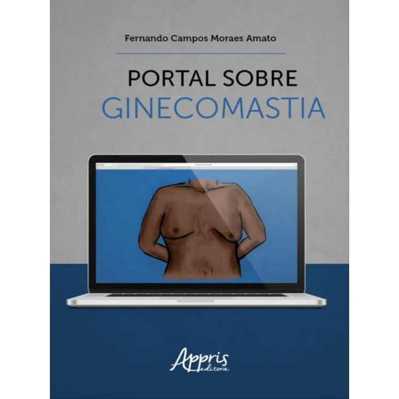 PORTAL SOBRE GINECOMASTIA